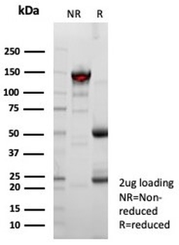 Mesothelin Antibody / MSLN