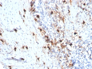 Recombinant TPSAB1 Antibody / Tryptase