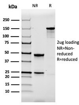 TPSAB1 Antibody / Mast Cell Tryptase