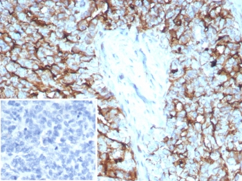 Recombinant Mesothelin Antibody