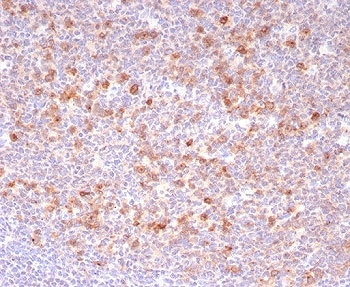 B-cell maturation protein Antibody / BCMA / CD269 / TNFRSF17