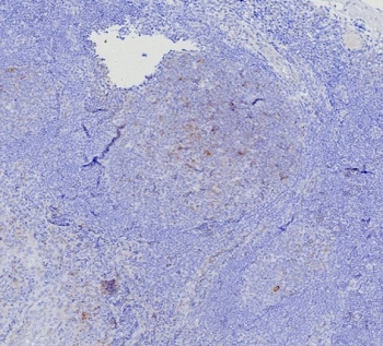 Recombinant BCMA Antibody / CD269 / TNFRSF17