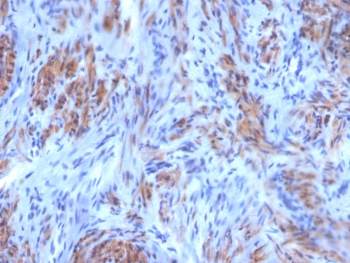 SMMHC Antibody / MYH11