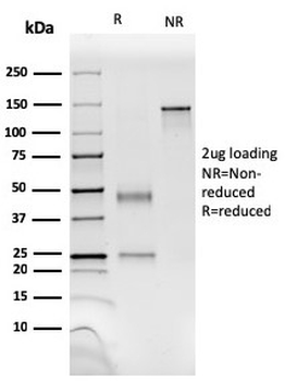 SMMHC Antibody / MYH11