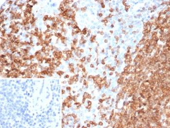 PLK1 Antibody / Polo like kinase 1