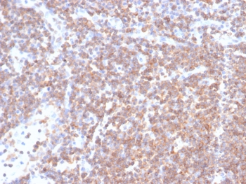 PLK1 Antibody / Polo like kinase 1
