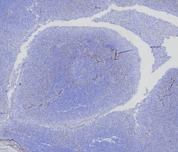 Recombinant BCMA Antibody