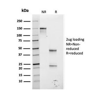 Glycoprotein 2 Antibody / GP2 / ZAP75