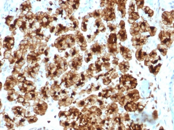 Glycoprotein 2 Antibody / GP2 / ZAP75