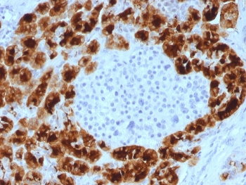 Glycoprotein 2 Antibody / GP2 / ZAP75