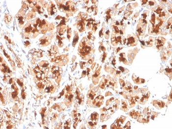 Glycoprotein 2 Antibody / GP2 / ZAP75