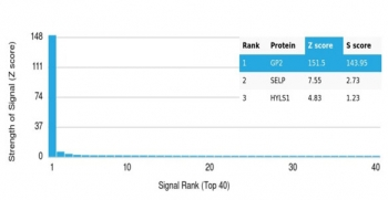 Glycoprotein 2 Antibody / GP2 / ZAP75
