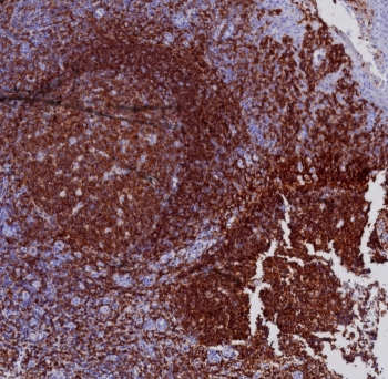 CD19 Antibody / B-lymphocyte marker
