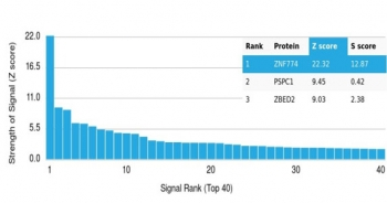 ZNF774 Antibody / Zinc finger protein 774