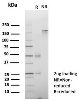 ZNF774 Antibody / Zinc finger protein 774