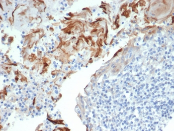 TrkC Antibody