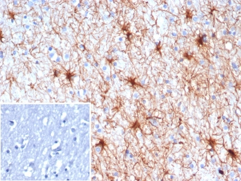 TrkC Antibody