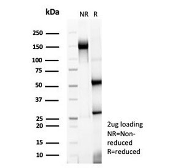 TrkC Antibody