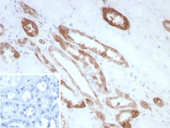 Creatine kinase B Antibody / CKBB / CKB