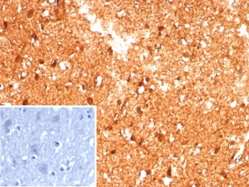 Creatine phosphokinase BB Antibody / CKBB / CKB