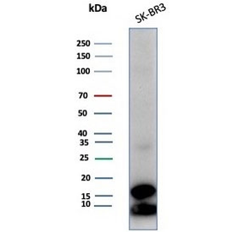 GCHFR Antibody / GFRP