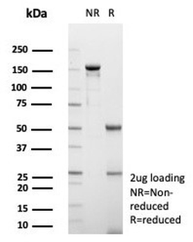 GCHFR Antibody / GFRP