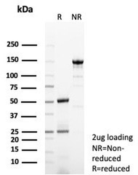 GCHFR Antibody / GFRP