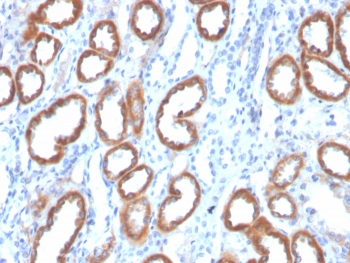Thrombospondin-1 Antibody / THBS1