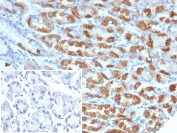 Thrombospondin-1 Antibody / THBS1