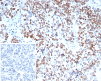 MEIS2 Antibody