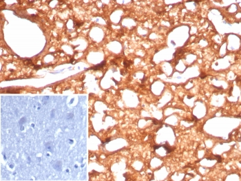 Brain Creatine Kinase Antibody / CKBB