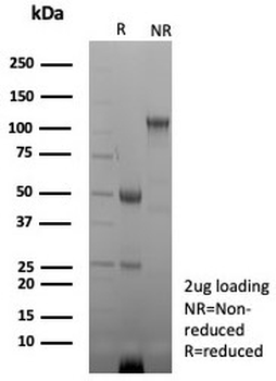 Brain Creatine Kinase Antibody / CKBB