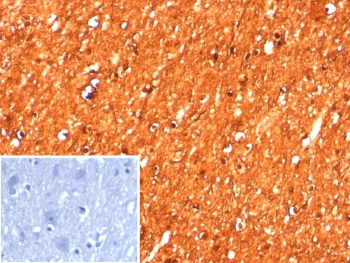 Creatine kinase B Antibody / Brain Creatine Kinase / CKBB