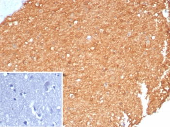 CKB Antibody / Creatine kinase B