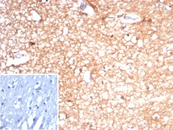 Recombinant CKBB Antibody / Creatine kinase B