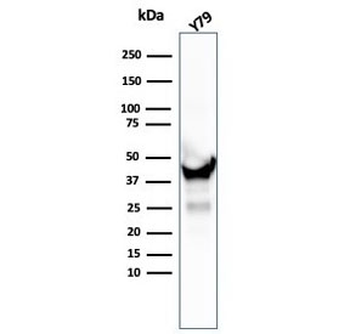 CKB Antibody / Creatine kinase B