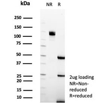 YY1 Antibody