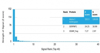 Alpha-1-Antitrypsin Antibody / AAT / SERPINA1