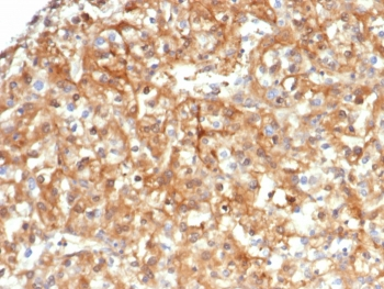 Alpha-1-Antitrypsin Antibody / AAT / SERPINA1