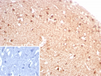 Recombinant CKBB Antibody / Creatine kinase B