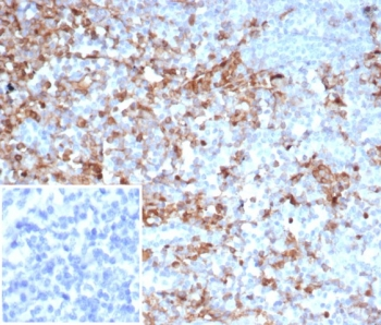 SERPINA1 Antibody / Alpha 1 Antitrypsin / AAT