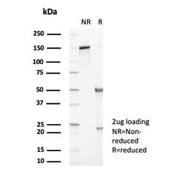 SERPINA1 Antibody / Alpha 1 Antitrypsin / AAT