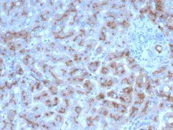 Alpha 1 Antitrypsin Antibody / AAT / SERPINA1