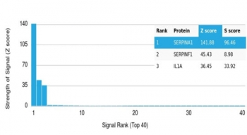 Alpha 1 Antitrypsin Antibody / AAT / SERPINA1