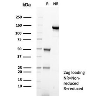 Alpha 1 Antitrypsin Antibody / AAT / SERPINA1