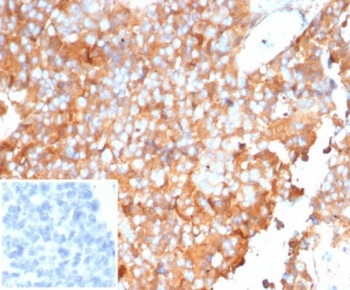 Alpha 1 Antitrypsin Antibody / AAT / SERPINA1