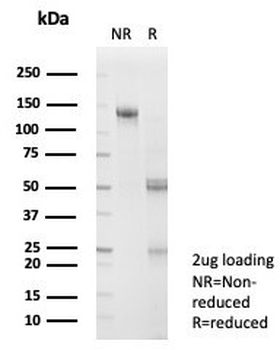 SNW1 Antibody / NCoA-62 / SKIP