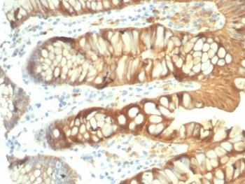 Galectin 3 Antibody