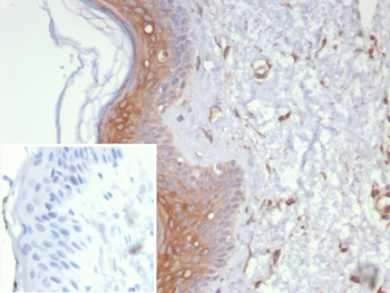 Galectin 3 Antibody