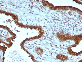 Galectin 3 Antibody